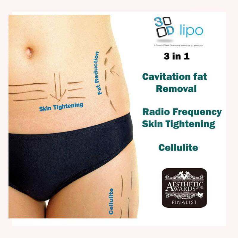 https://www.lasaderm.co.uk/wp-content/uploads/2018/01/3d-lipo-cavitation.jpg