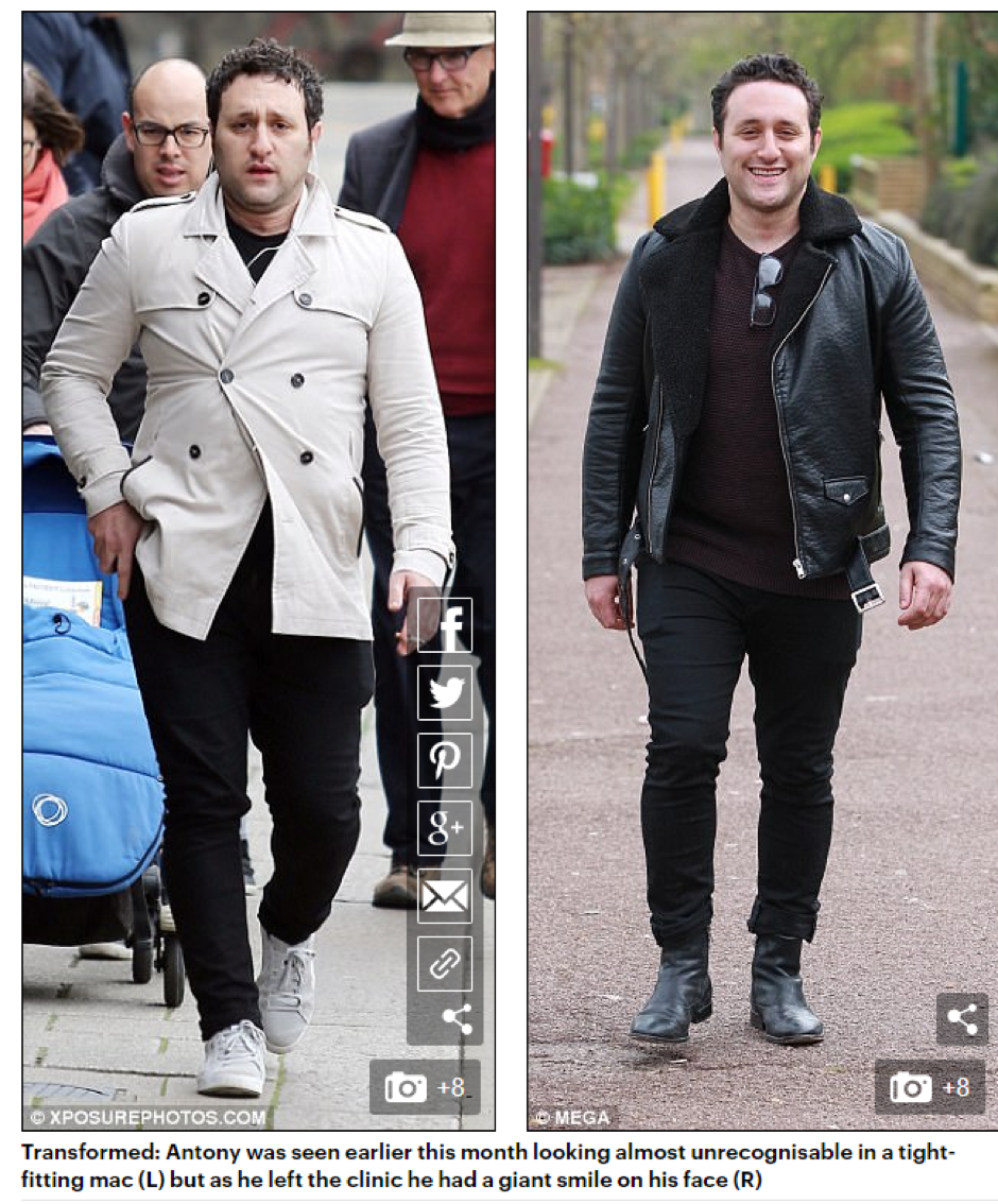 Antony Costa Before and After Images
