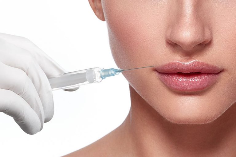 Lip Filler Injections