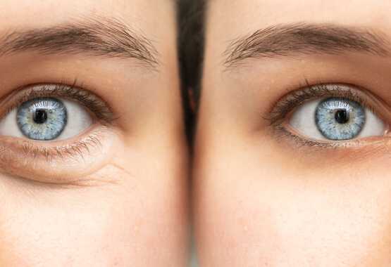 eyes