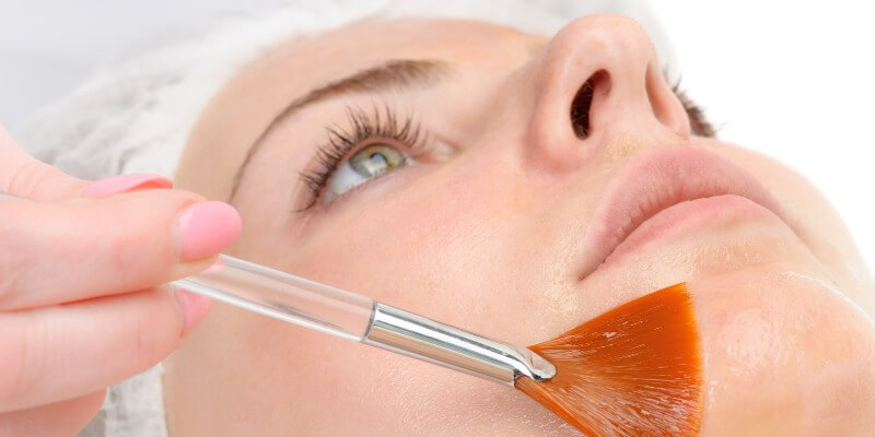 Chemical Peel