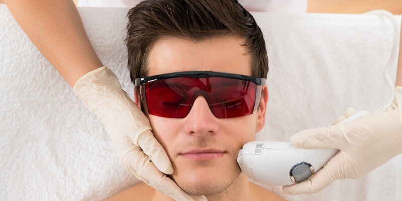 man getting laser hair removal on face