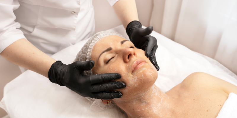 Chemical peel procedure