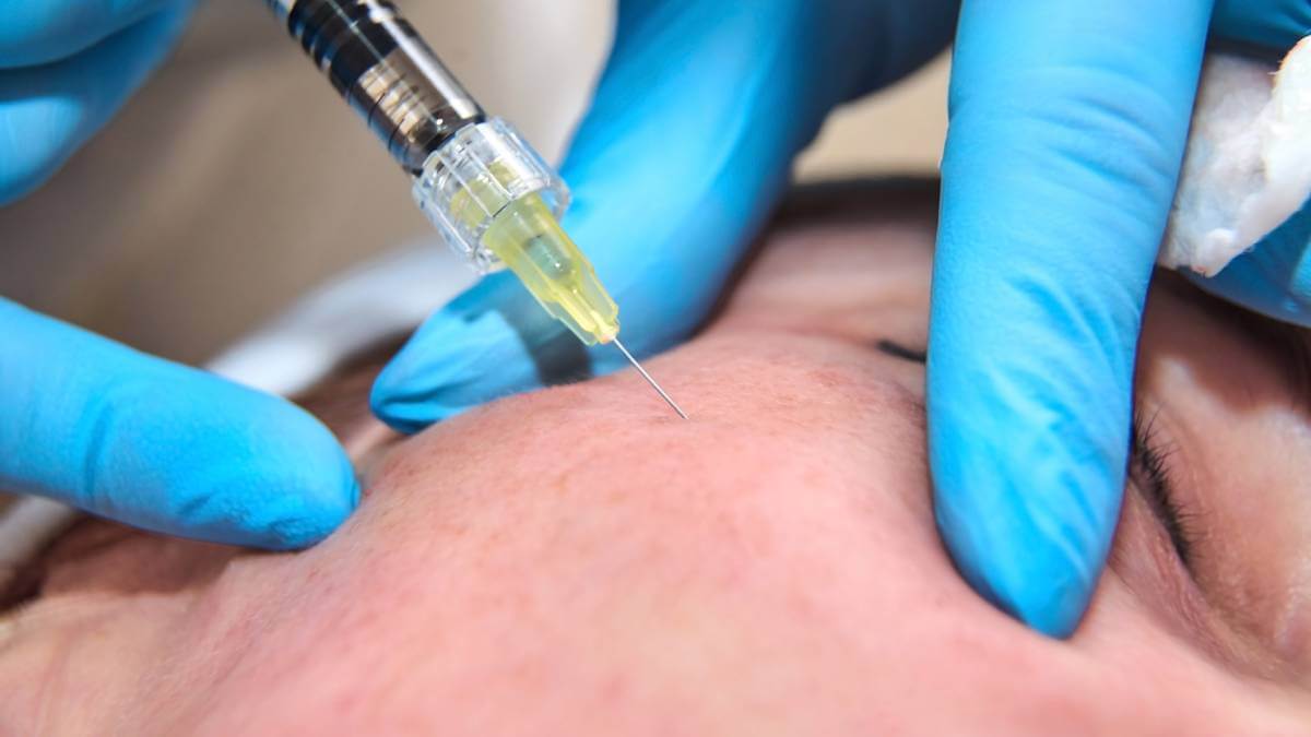 A picture of facial treatment using a needle