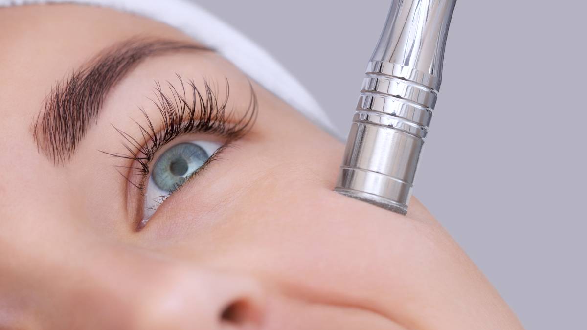 close up microdermabrasion