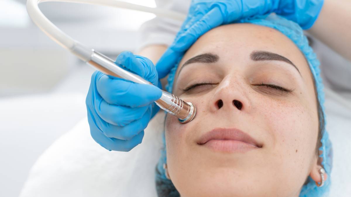 Microdermabrasion front