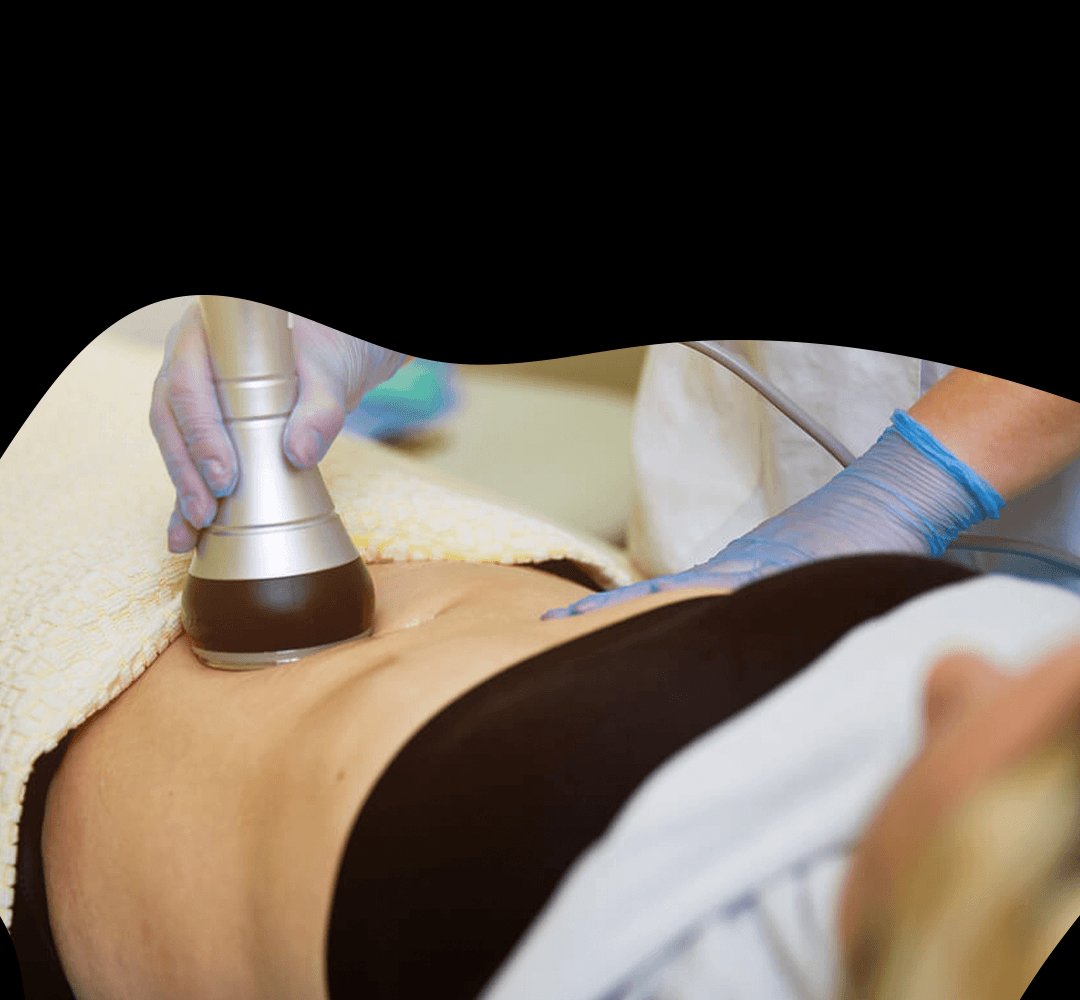50% Off 3D Lipo Treatments