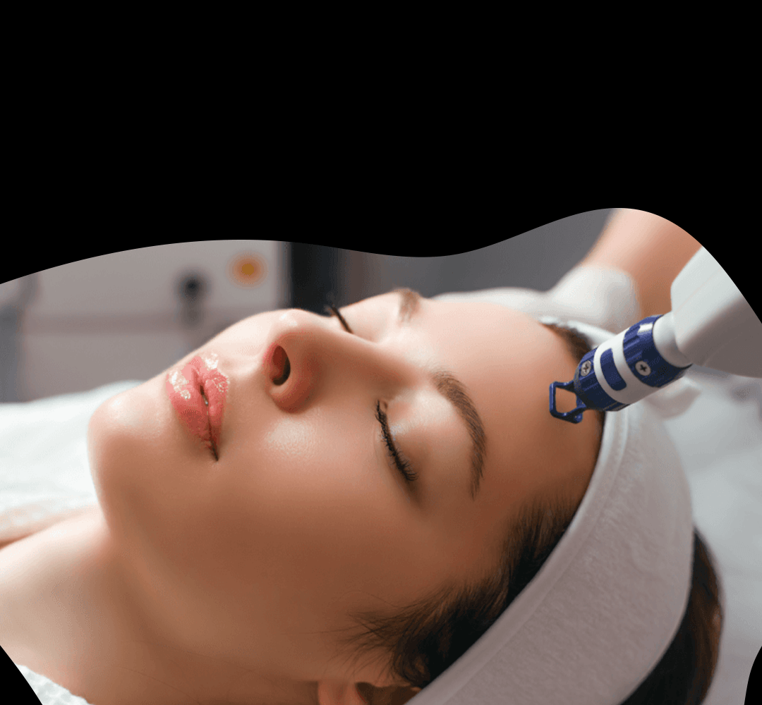 30% All Laser Treatments